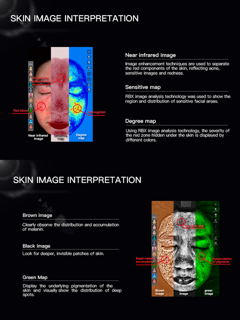 Белый оптовый 3D интеллектуальный анализатор кожи Ios Ai для спа