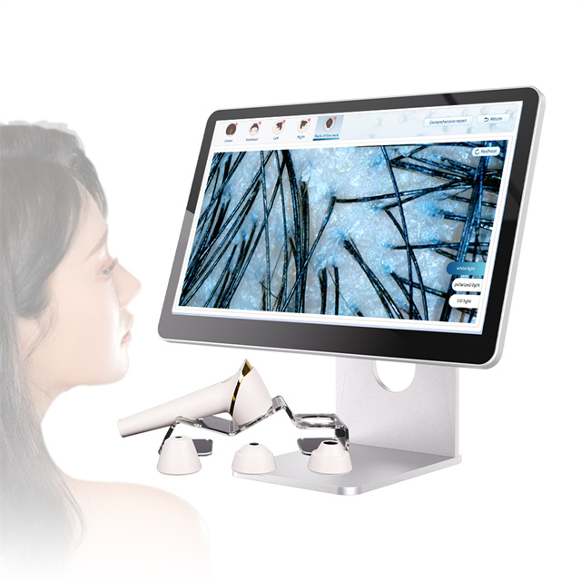 Am-216 Портативный профессиональный детектор кожи для ухода за лицом AI Лампа Вуда Анализатор кожи и волос